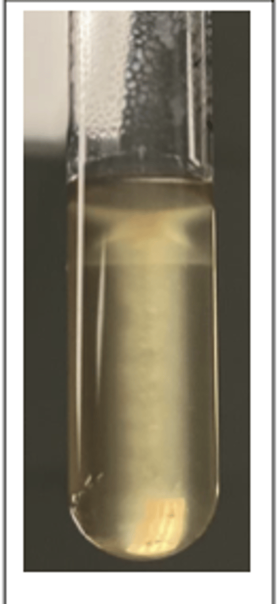 <p>This pathogen was isolated from the brain stem of a cow with unilateral neurological signs. Presumptive diagnosis was "circling disease". A selective broth enrichment culture technique was used to isolate the pathogen provided. This organism is catalase-positive and CAMP-positive.</p><p>See SIM test, what is diagnosis</p>