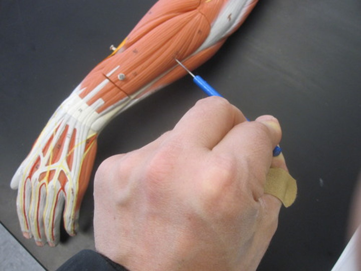 <p>extends and adducts wrist</p>