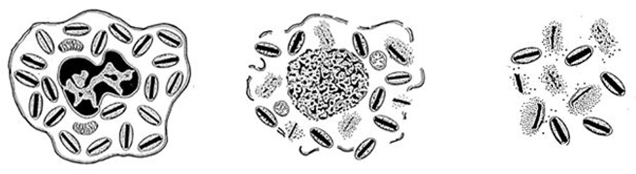 <p>•Biggest problem is intracellular ice formation:</p><p style="text-align: left">- causes severe disruption to cell membranes (and organelles).</p><p>•</p><p>•Not apparent on freezing – but on thawing very poor (or practically zero) cell viability.</p><p><span>•Intracellular ice formation is minimised by using a cryoprotectant</span></p><p><span>•</span></p><p><span>•Most commonly used is DMSO (dimethylsulphoxide)</span></p><p></p>