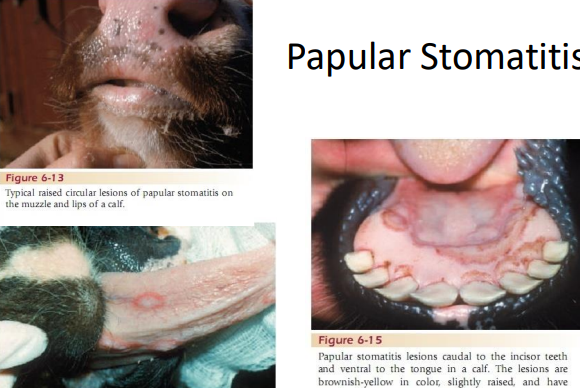 <p><span>Papular Stomatitis</span></p>