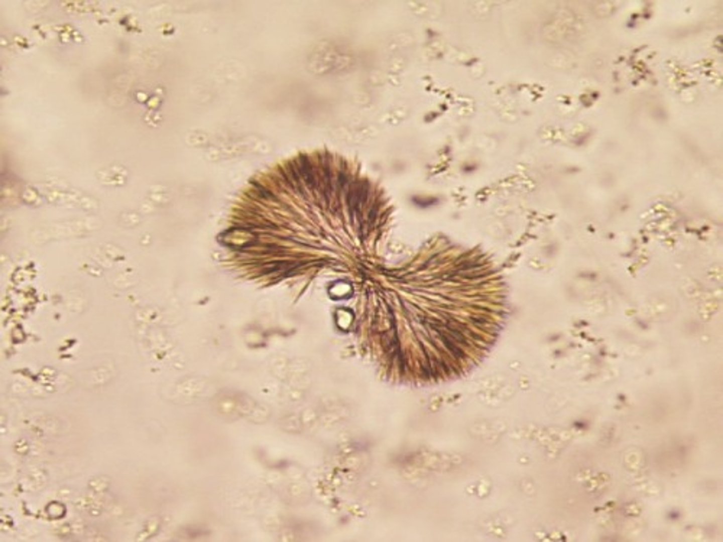 <p>dehydration, shapes include neeldes, rhombic, whetstones, sheaves of wheat, and rosettes with colors ranging from colorless to yellow brown, infection treatment</p>