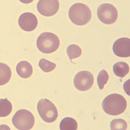 <p>What do these erythrocytes show?</p>