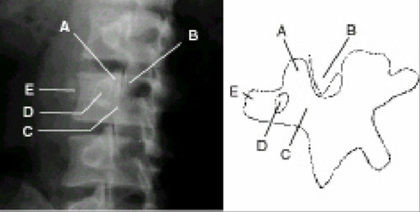 <p>an oblique view of the Lumbar Spine</p>
