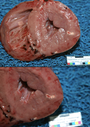 <p>Morphologic diagnosis </p>