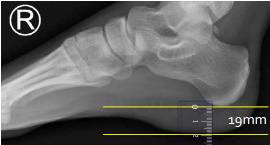 <p>Q what is the name of this measurement? and what is the average + range?</p>