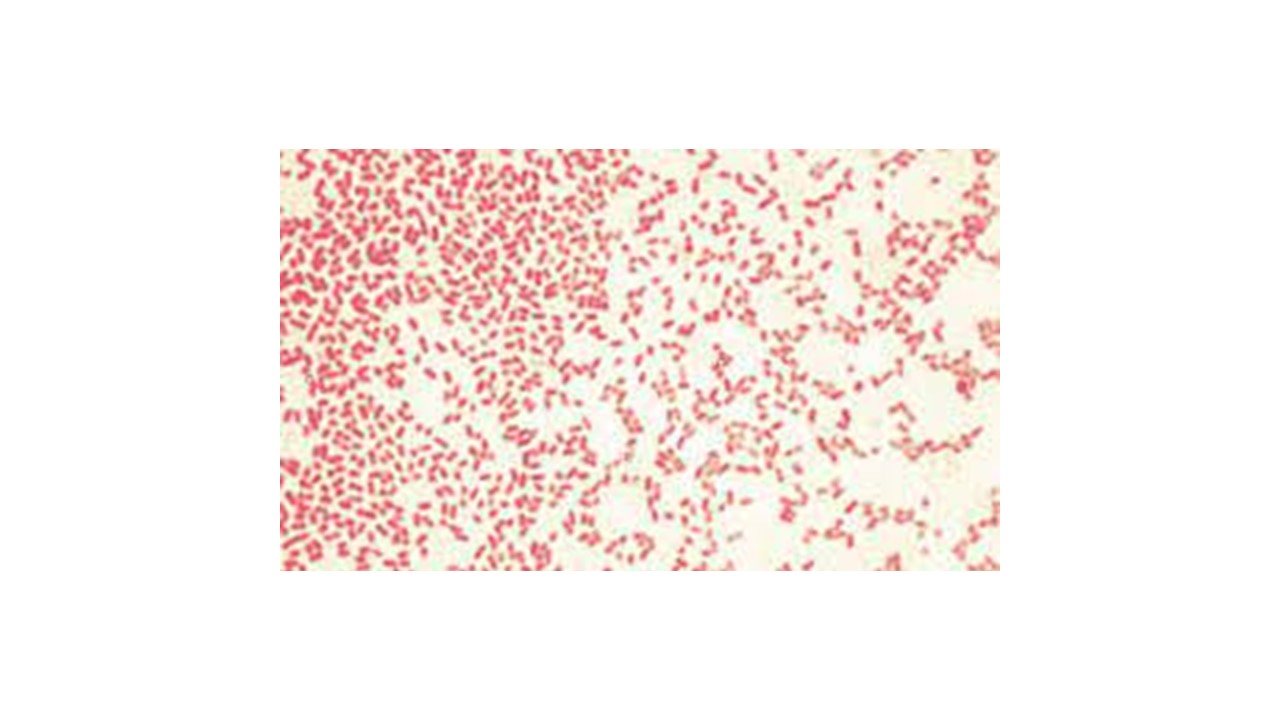 <p>gram negative&nbsp;</p>