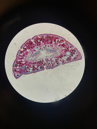 Be able to label the phloem, xylem, epidermis, cuticle, resin ducts, and mesophyll
