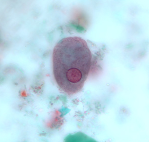 <p>Professor: Dr. Glena Fe A. Yapchulay-Alcabasa</p>