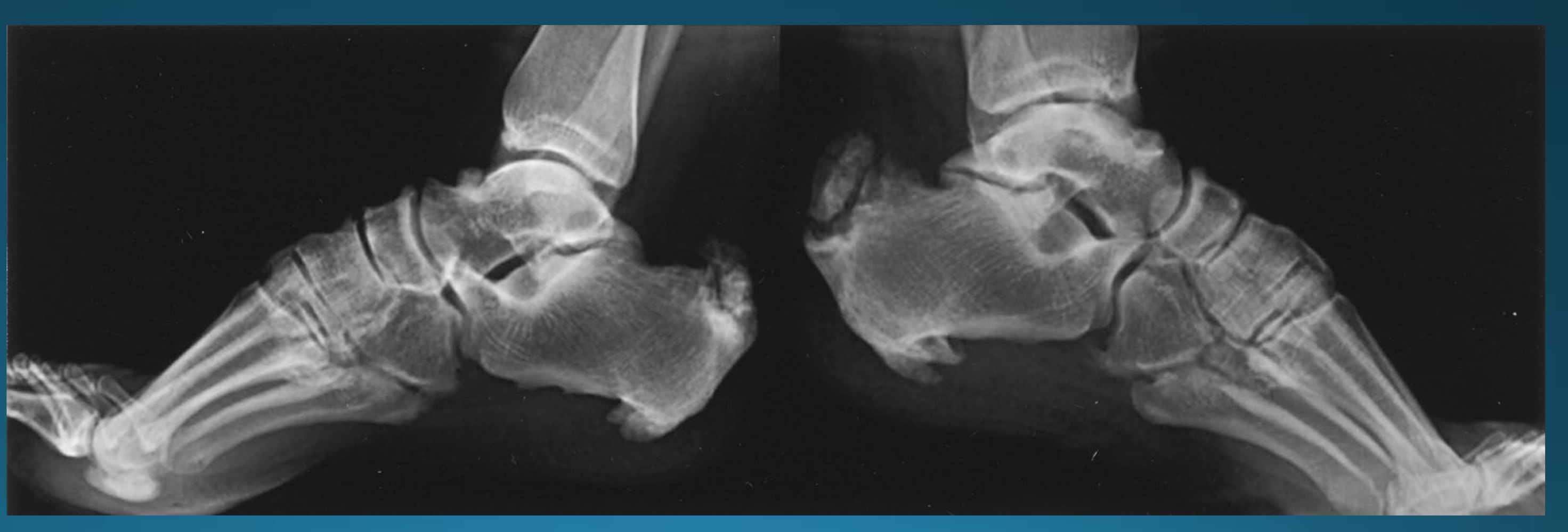 <p>what is this radiographic feature associated with? </p>