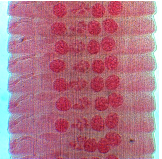 What do you call the form where one proglottid overlaps another