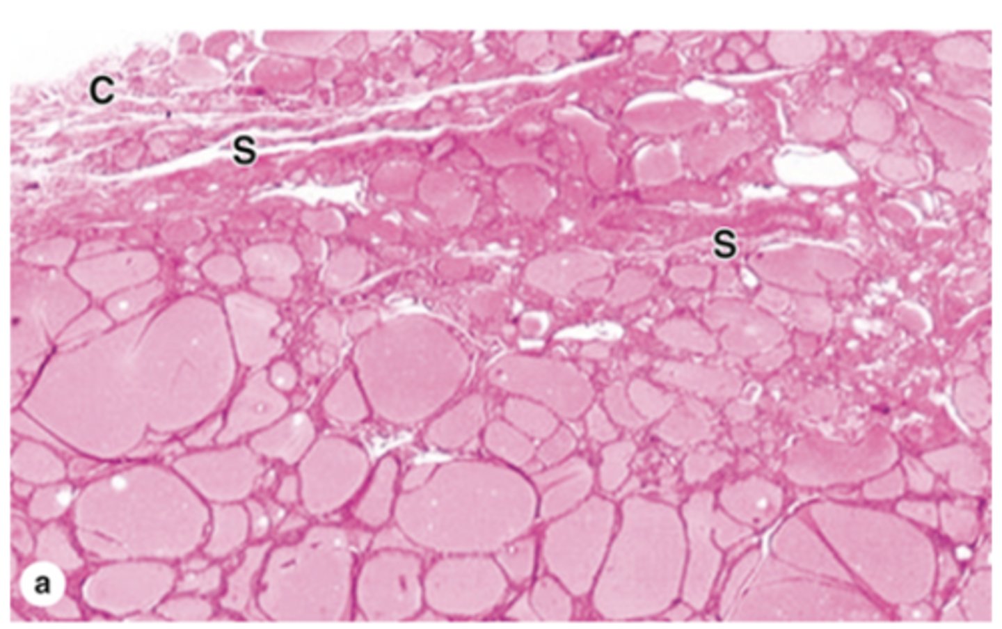 <p>What connective tissue supports the thyroid follicles?</p>