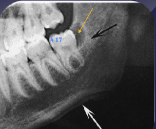 <p>what are the white + black arrows </p>