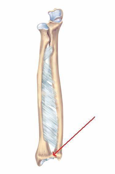 <p>distal; smooth divot; opposite side of styloid process</p>