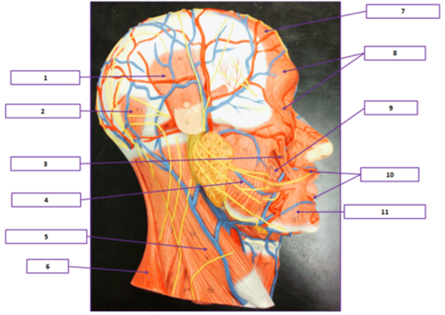 <p>Identify the muscle labeled 11.</p>