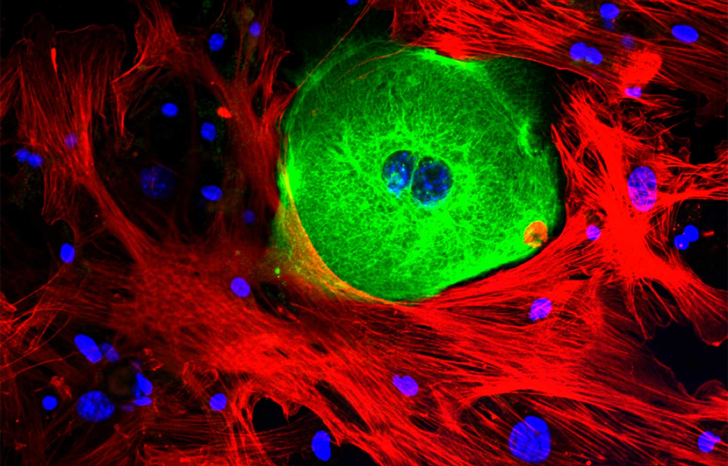 <ul><li><p>View thin slices of living samples</p></li><li><p>Can look at protein expression and specific parts of cell (chromosomes during mitosis) </p></li></ul><p></p>