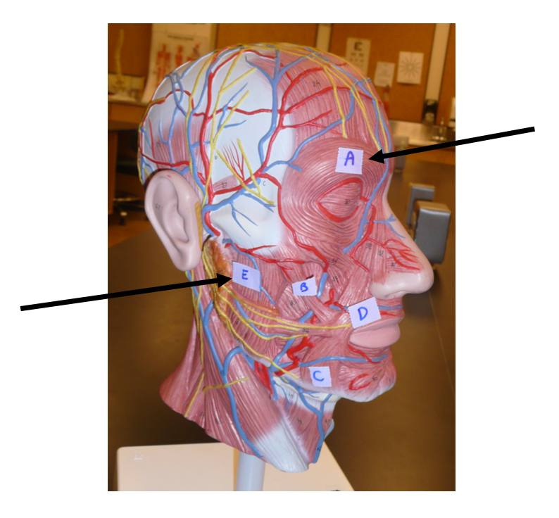 <p>Identify the muscle labeled E on the model</p><p></p><p>A. zygomaticus</p><p>B. buccinator</p><p>C. masseter</p><p>D. temporalis</p>