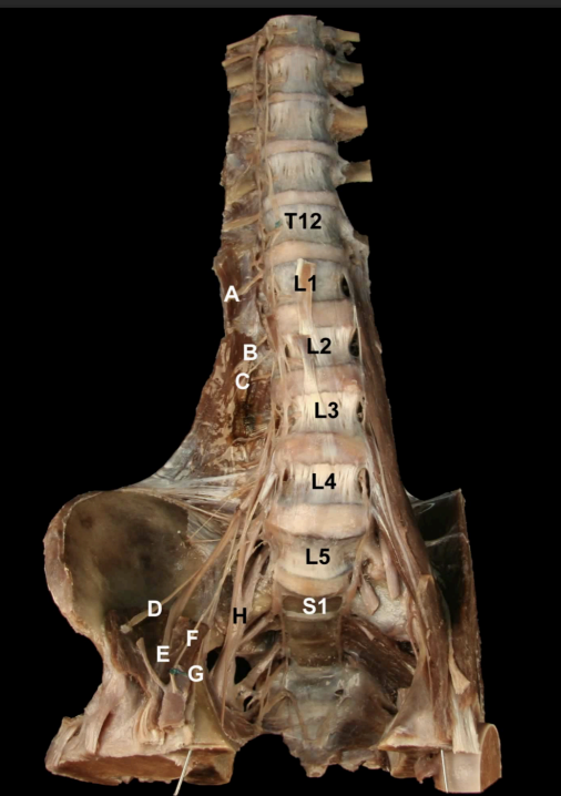 <p>Identify the Nerves and their corresponding nerve levels indicated on this <strong>Anterior view</strong> of the Pelvis:<strong> Lumbar Plexus</strong></p>
