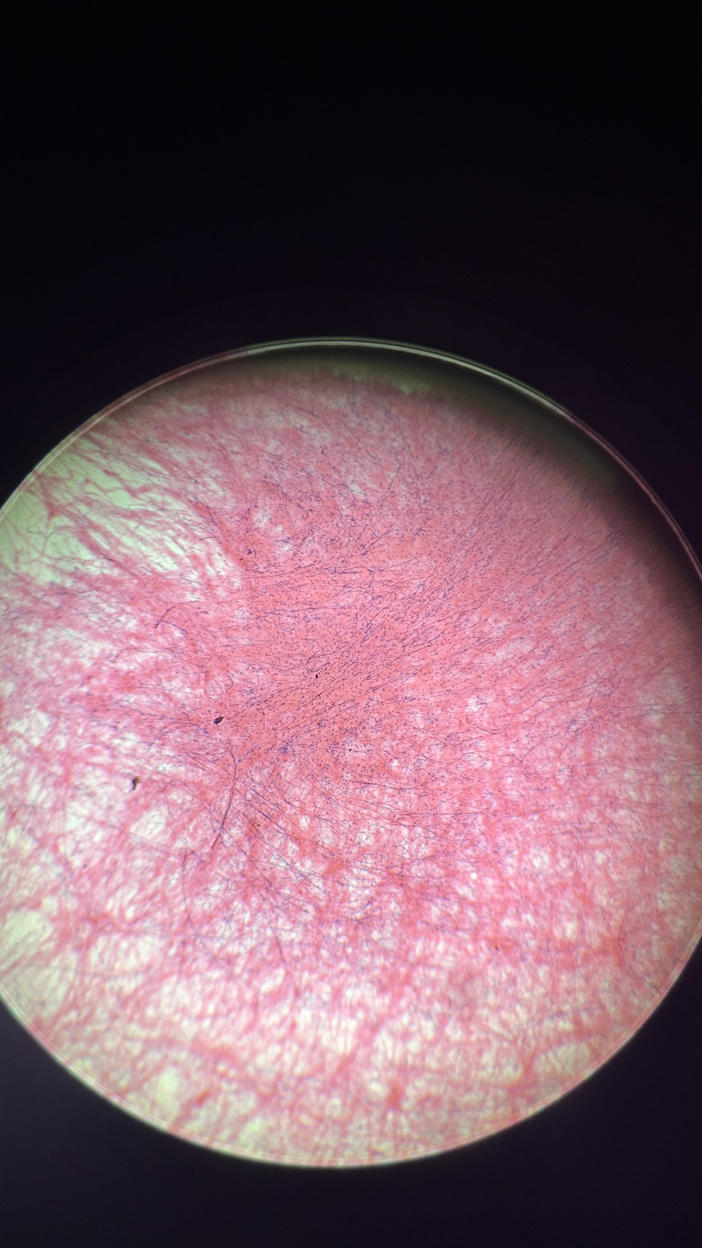 <p>What is the magnification level of the Loose (areolar) CT? </p>