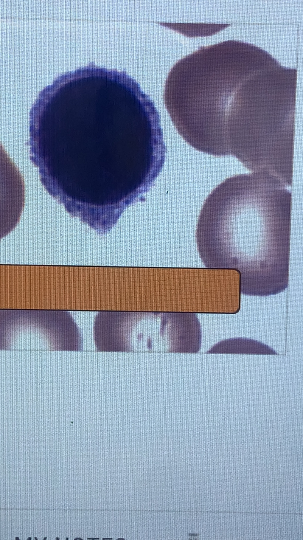 <p>lymphocyte</p>