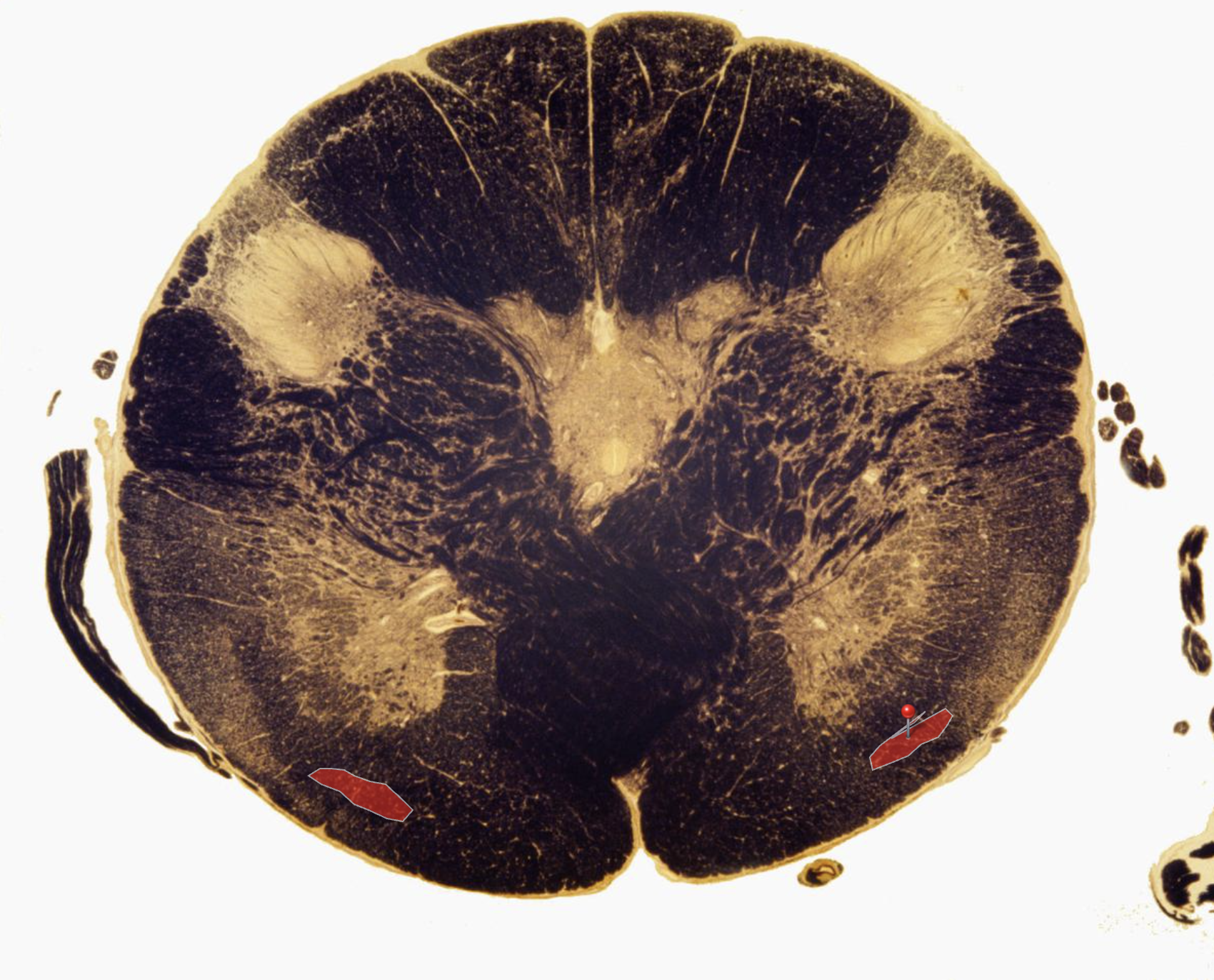 <p>What level of the brainstem is this taken from? and What is the highlighted structure?</p>