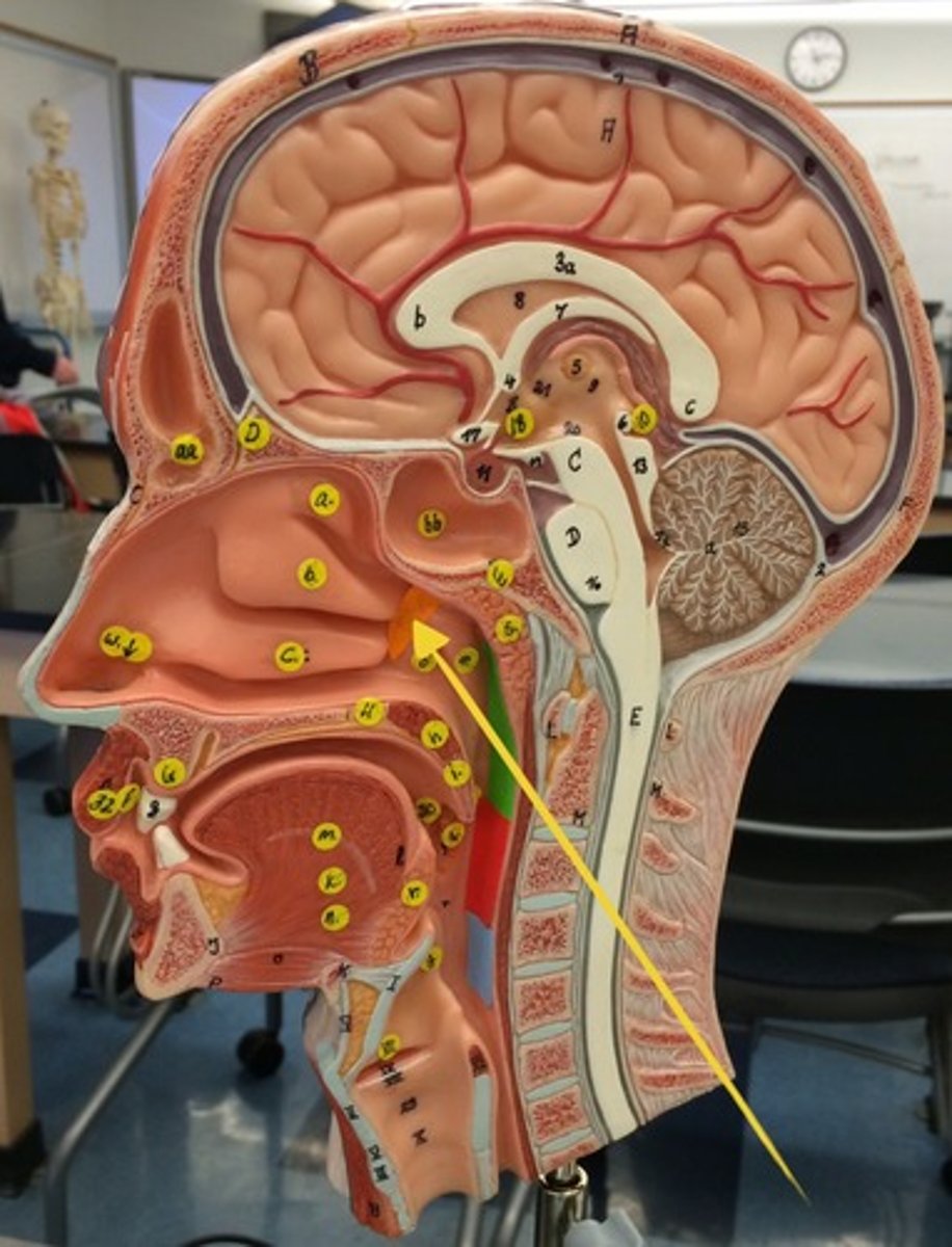 <p>#17 white lined depression </p><ul><li><p>depression</p></li></ul><p></p>