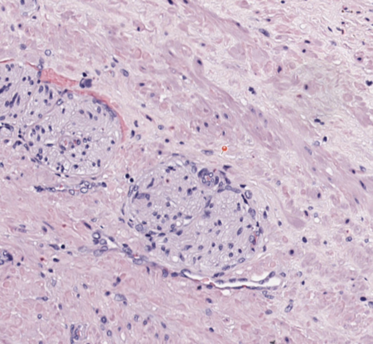 <p>Prostate</p>