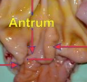 <p>Name the normal structure in the pig stomach pointed by the arrow on the right</p>