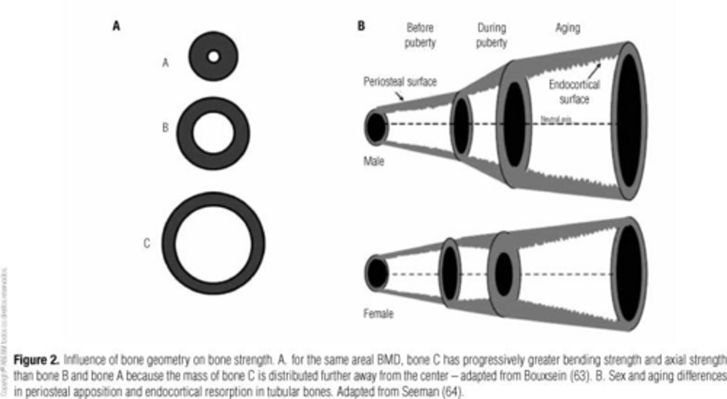 <p>It measures resistance to bending load in a bone.</p>