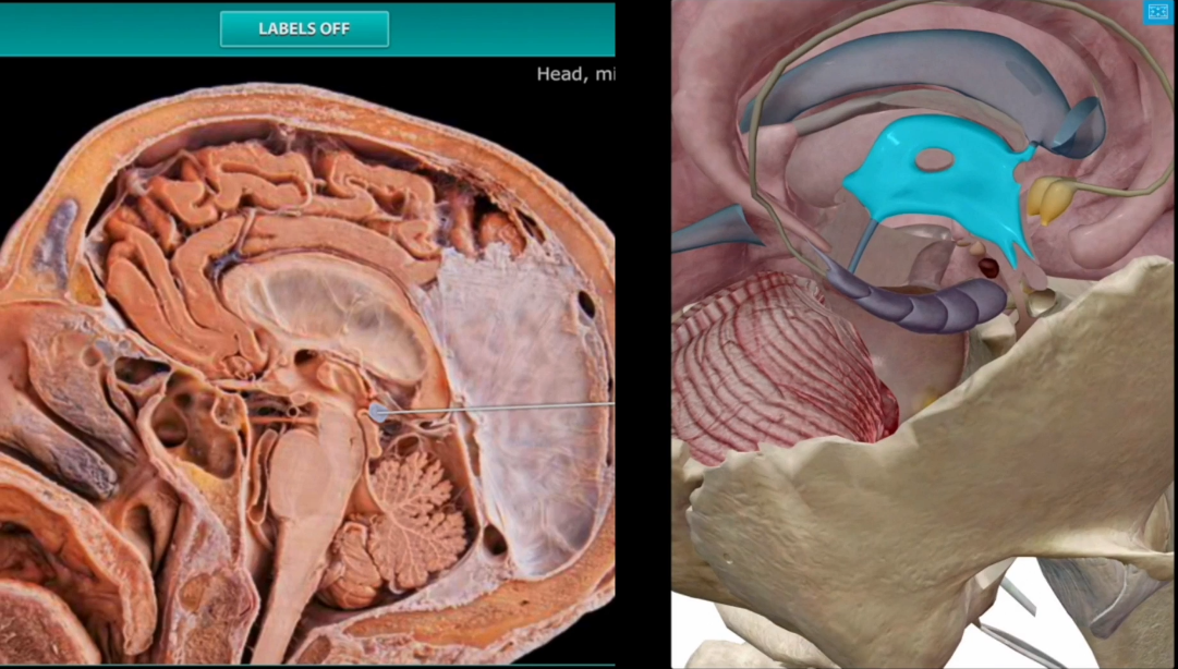 <p>Near the posterior aspect of the third ventricle </p>