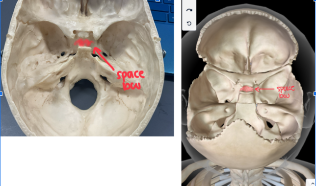 <p>Part of the <strong>SPHENOID BONE </strong></p>
