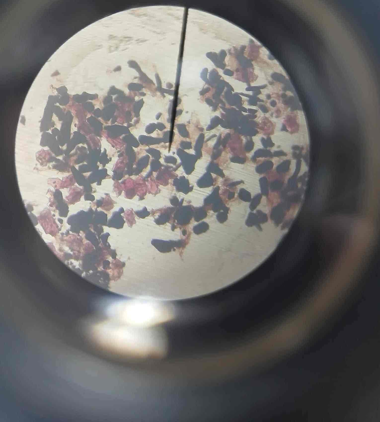 <p>A plant with irregularly thick secondary walls.</p>