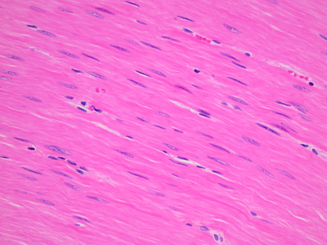 <p>What type of muscle tissue is shown in the image?</p>