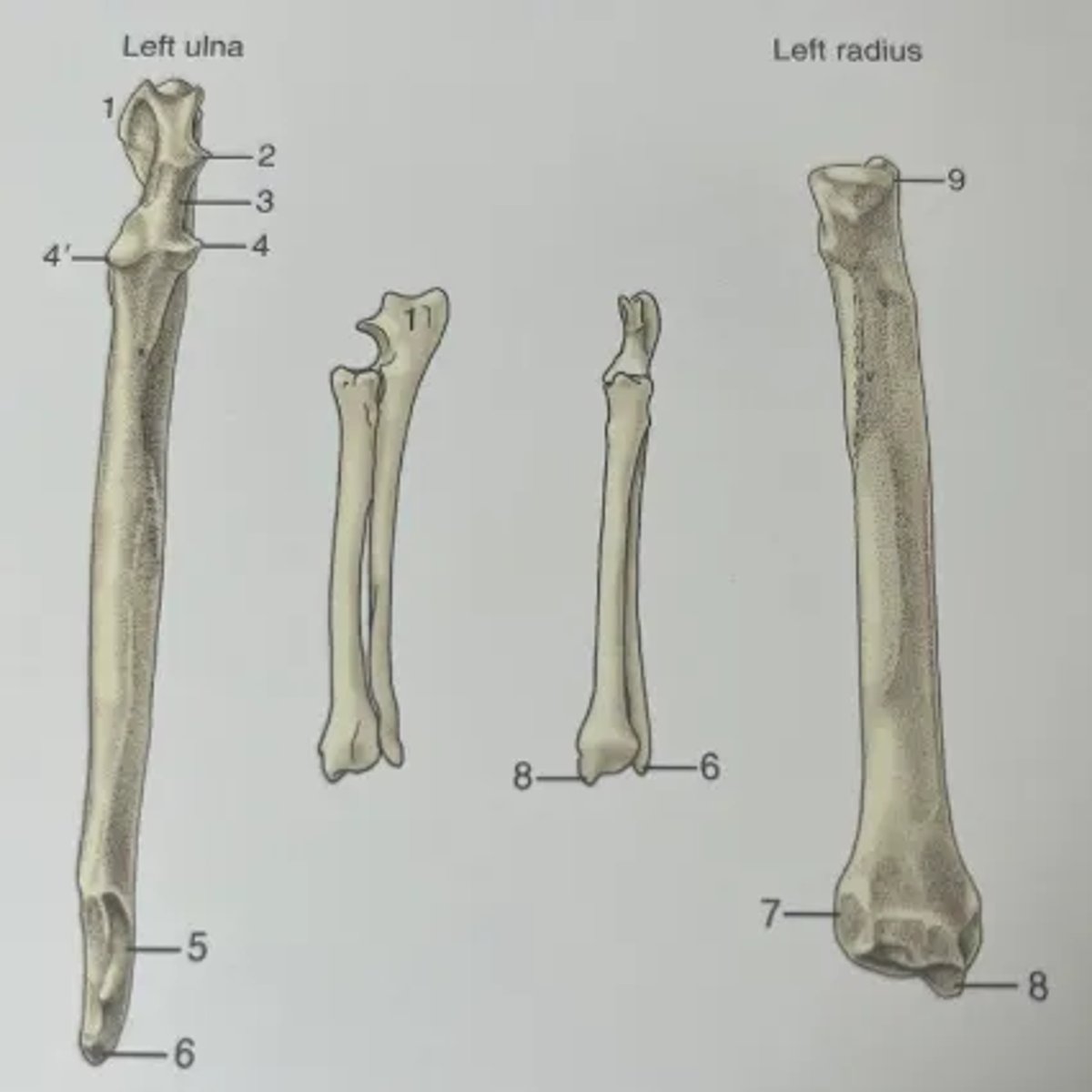 <p>1. Olecranon</p><p>2. Anconeal process</p><p>3. Trochlear notch</p><p>4. Lateral and medial coronoid processes</p><p>5. Distal articular facet for radius</p><p>6. Lateral styloid process</p><p>7. Articular facet for ulna</p><p>8. Medial styloid process</p><p>9. Articular circumference</p>