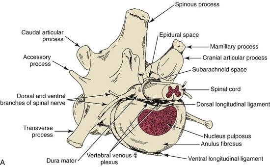 <ol><li><p>Vertebral body</p></li><li><p>IV disc</p></li><li><p>Dorsal/ventral longitudinal ligaments</p></li><li><p>Inter-transverse ligaments</p></li></ol><p></p>