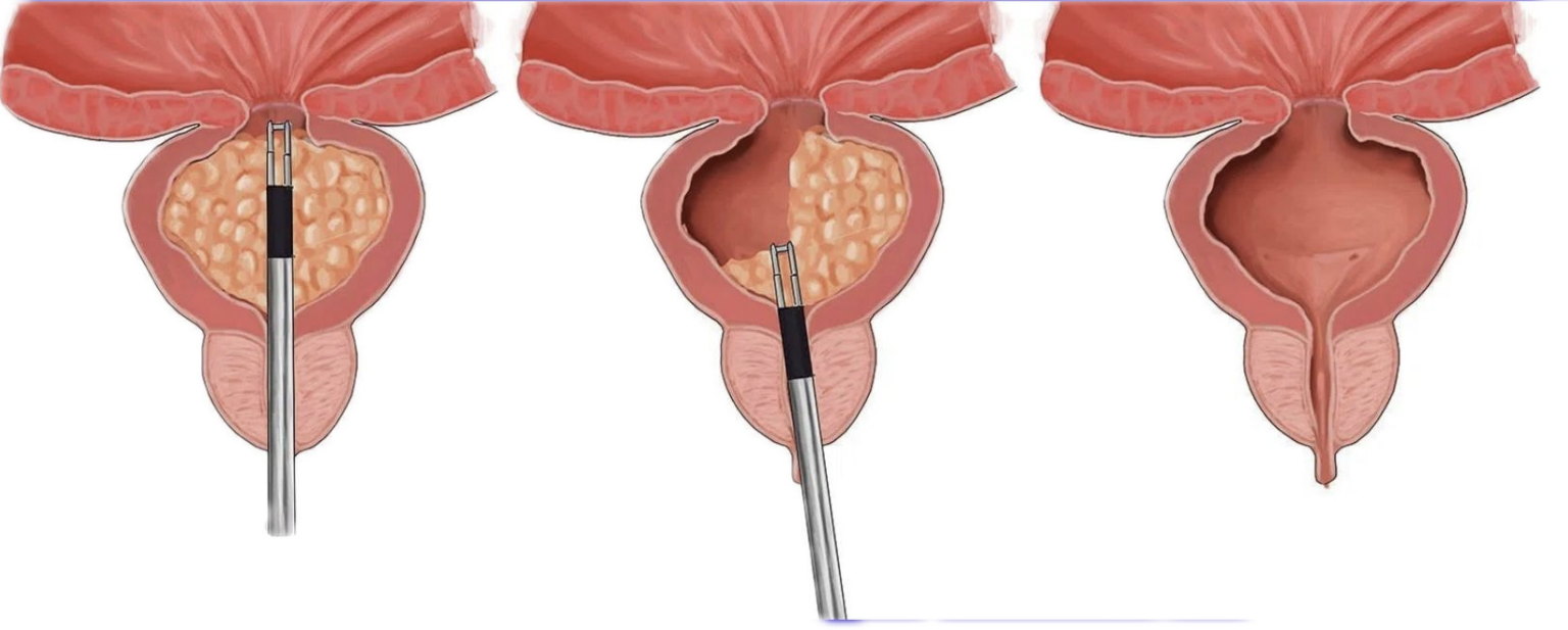 <p>What is being demonstrated in this image?</p>