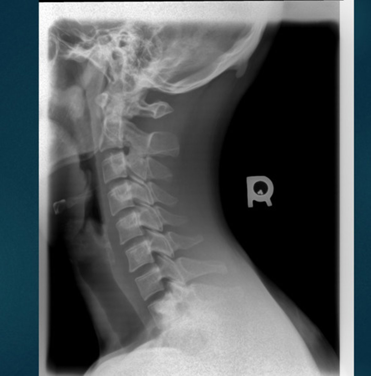 <p>What projection view is this?</p>