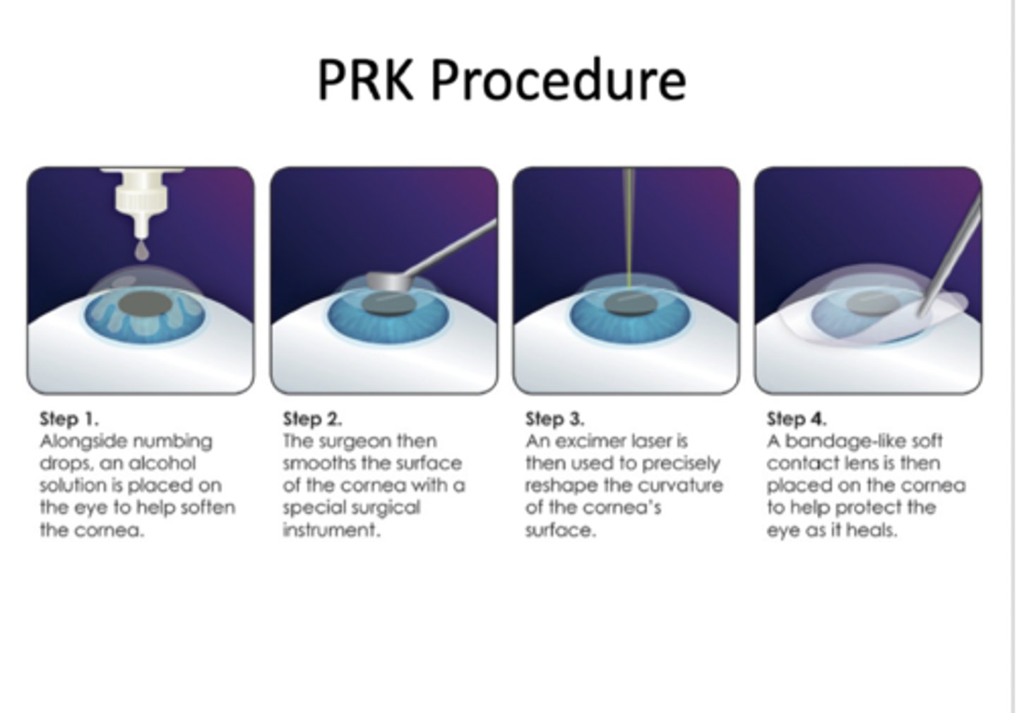 <p>Corneal epithelium is debrided with surgical tool</p><p>-193-nm argon fluoride excimer laser used to ablate anterior stroma</p><p>-Bandage contact lens placed over the cornea</p><p>-Re-epithelialization of cornea over ablated region</p><p>-Can be painful during the first 24 hours</p>