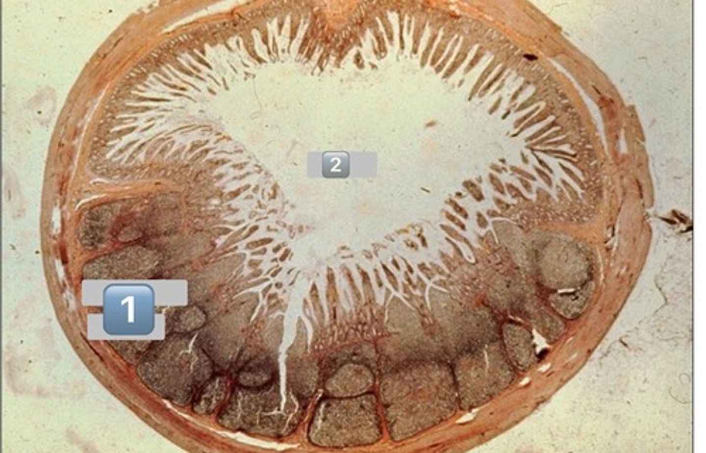 <p>lumen of small intestine</p>