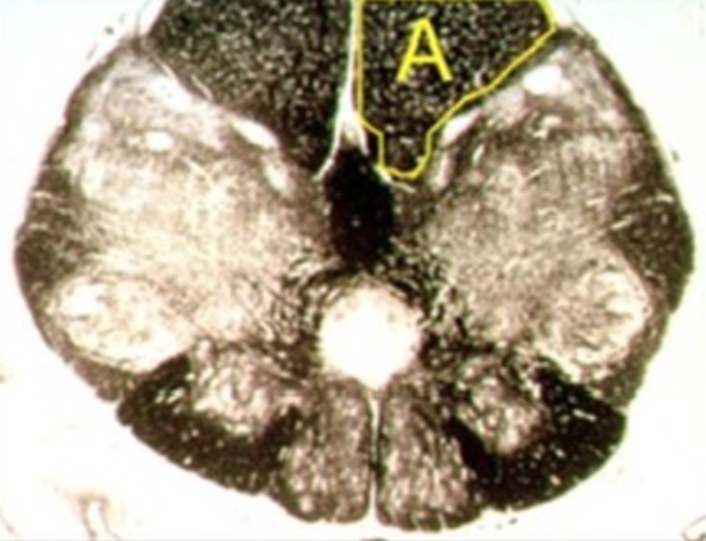 <p>Identify the structure indicated by the outline and letter "A."</p>