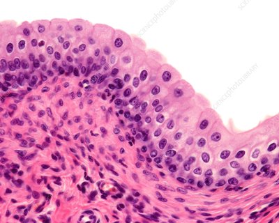 <p>transitional epithelium</p>