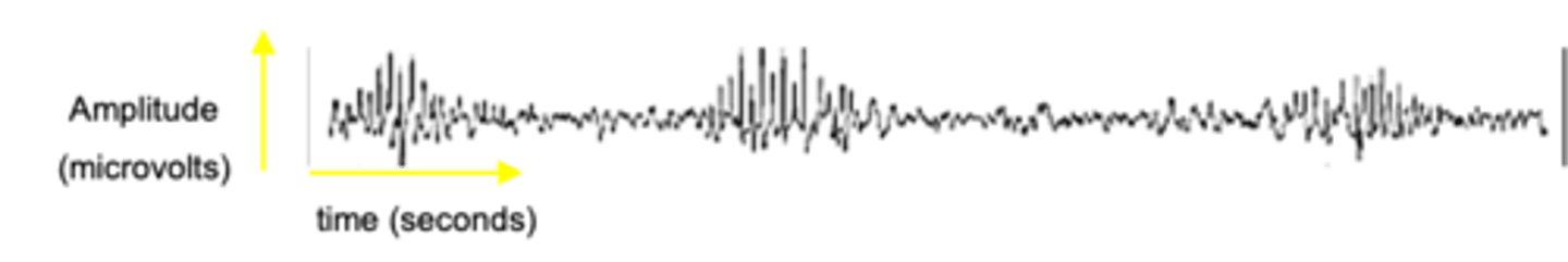 <p>What is stage 3 of non-REM sleep?</p>
