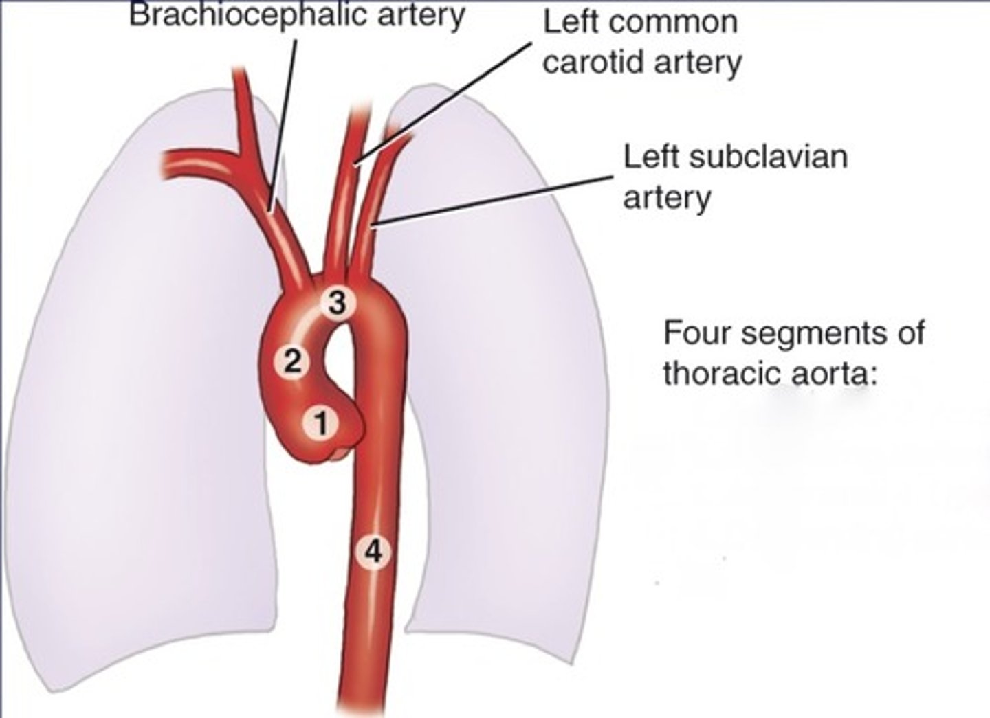 <p>Aortic bulb</p><p>Ascending aorta</p><p>Aortic arch</p><p>Descending aorta</p>