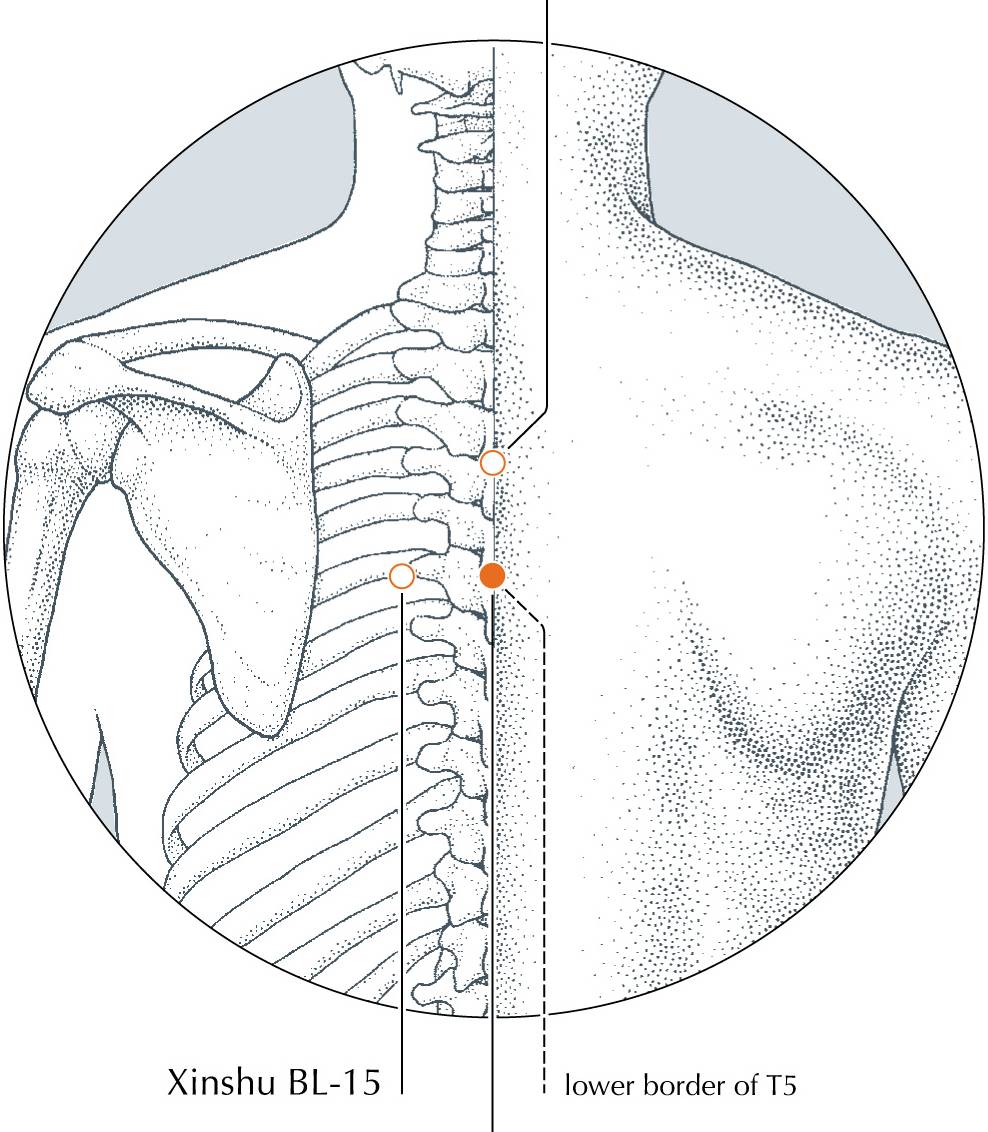 <p>DU-11</p>
