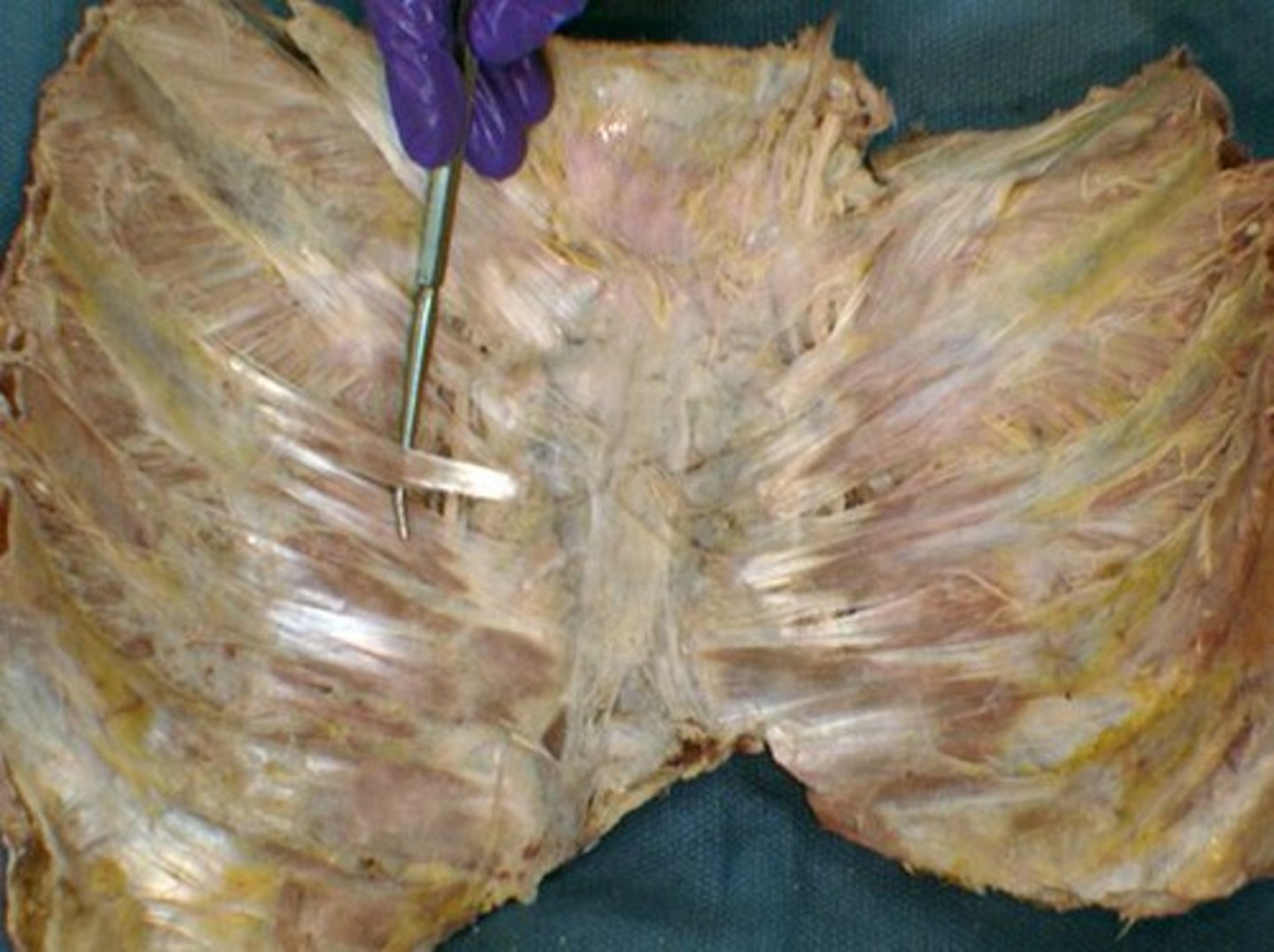 <p>muscle</p>