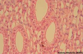 <p>rash look, pink background white ovals</p>