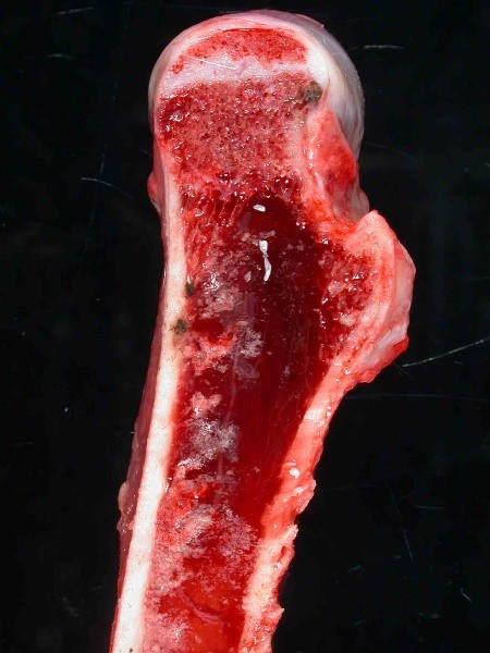 <p><span><span>This image depicts the bone marrow of the femur taken from an emaciated gazelle. There is complete loss of adipose (fat) from marrow cavity. The term used to describe this lesion is:</span></span></p><p>Fat necrosis</p><p></p><p>&nbsp;</p><p>Serous atrophy of fat</p><p>&nbsp;</p><p>Bone marrow hemorrhage</p>