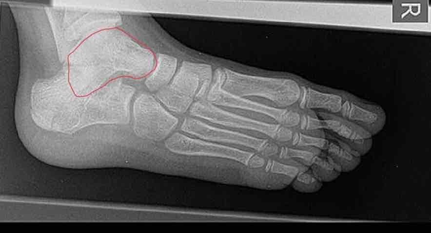 <p>What is this bone?</p>