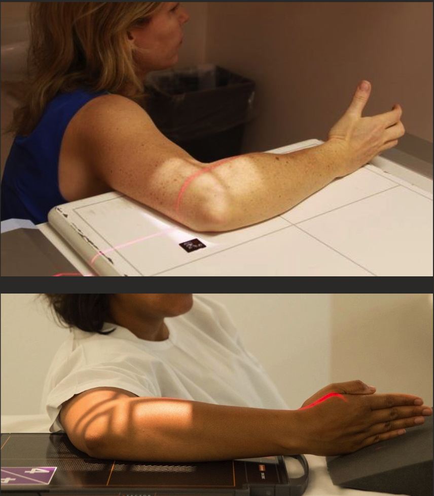 <ul><li><p>Hand wrist and elbow in “true lateral.”</p></li><li><p>Distal radius and ulna superimposed.</p></li><li><p>Humeral epicondyles superimposed (raise wrist to help).</p></li><li><p>CR perp to IR, centre to JOINT.</p></li><li><p>8-10cm of both distal humerus and proximal forearm.</p></li></ul><p></p>