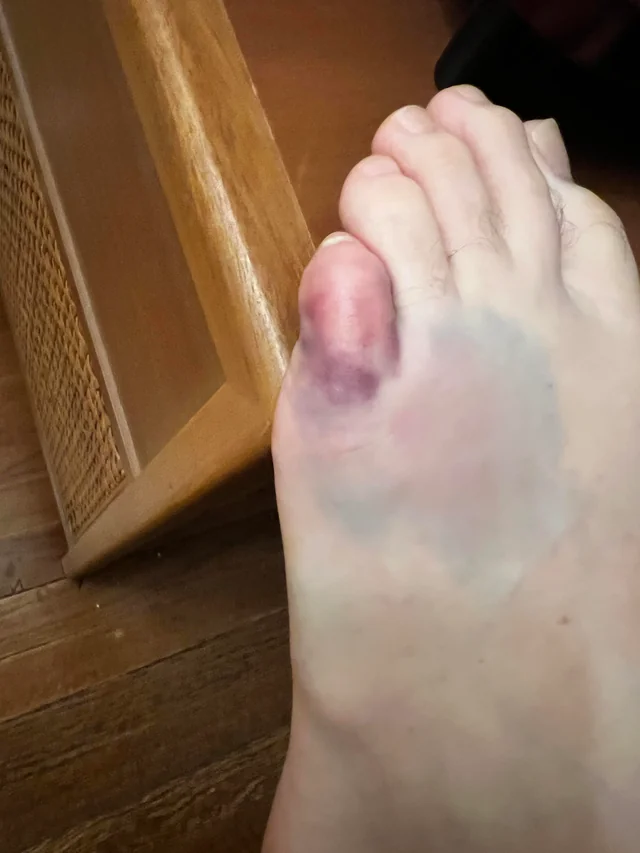 <p><strong>Heurter un obstacle du pied, trébucher, faire un faux pas</strong><br><strong>ou</strong><br><strong>échouer (figuré)</strong></p>
