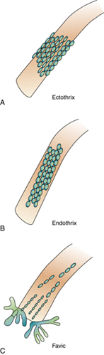 <p>What are the <strong>virulence factors </strong>of <strong>dermatophytes?</strong></p>